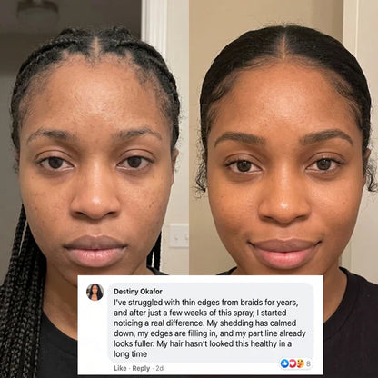 Rosemary + Rice Water Spray